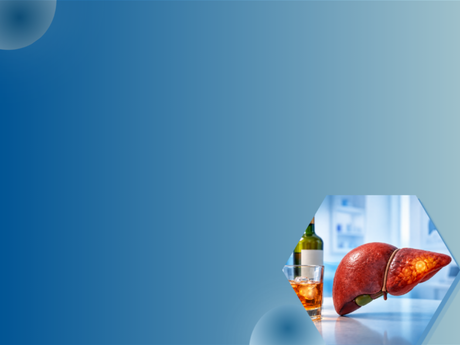 Alcohol Associated liver mob