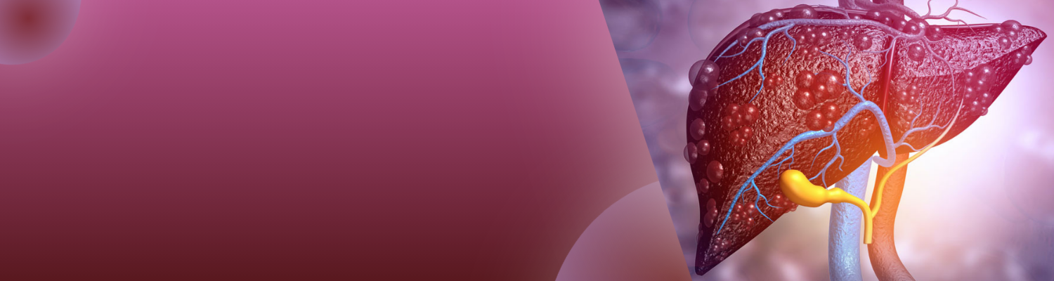 cirrhosis-chronic-banner Treatment